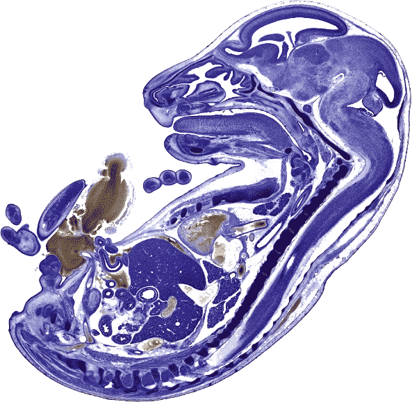 File:Rat fetus cryosection Nissl Brainmaps.org.png