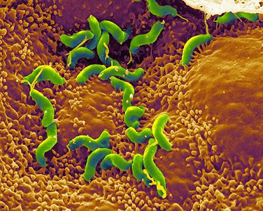 Helicobacter Pylori.jpg