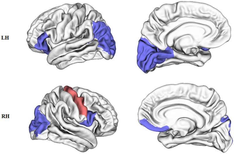 File:Surface mapping - altered network topology in early blind subjects.png