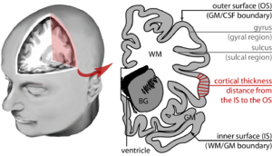 Brain morphometry overview.png