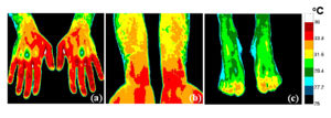 Normal extremity thermographic image.jpg