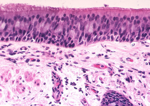 Normal respiratory mucosa lining a bronchus.png