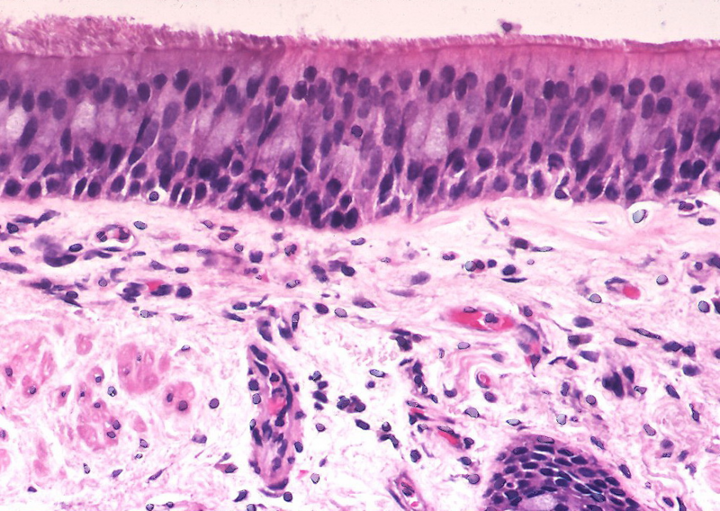 File:Normal respiratory mucosa lining a bronchus.png