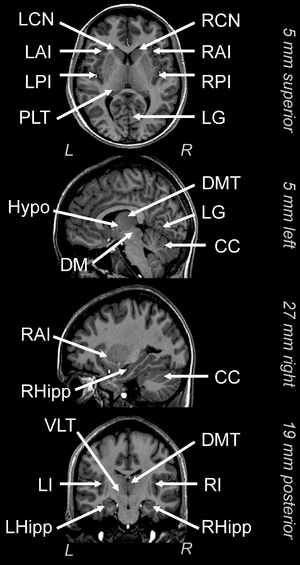 Brain-MRI-location-guide.png
