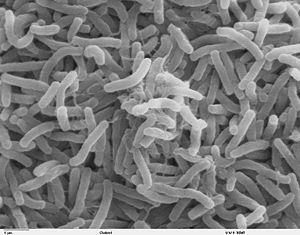 767px-Cholera bacteria SEM.jpg