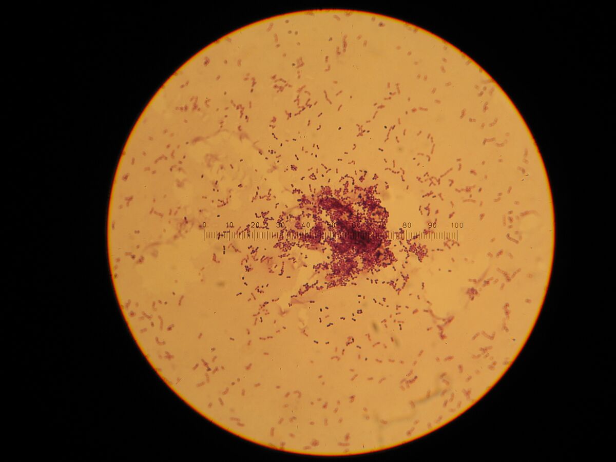 Streptococcus Lactis Under Microscope