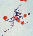 Gram-positive Streptococcus pyogenes