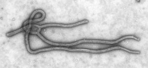 Ebola Virus TEM PHIL 1832 lores.jpg