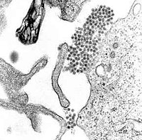 A TEM micrograph showing dengue virus.