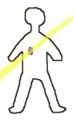 2 In teletherapy, gamma rays (yellow) are directed at the area of the body that contains the tumor.