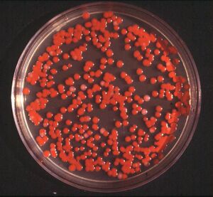 Serratia marcescens-1-.jpg