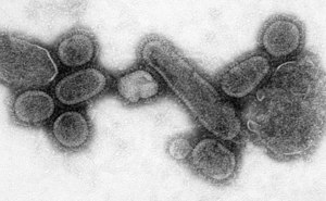 Reconstructed Spanish Flu Virus.jpg